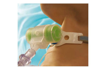 Hydro-Trach™ T Mk II HME Shown on Patient